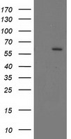 CYP17A1 Antibody in Western Blot (WB)