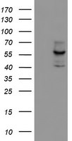 CYP17A1 Antibody in Western Blot (WB)