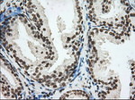 CYP1A2 Antibody in Immunohistochemistry (Paraffin) (IHC (P))