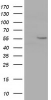 CYP1A2 Antibody in Western Blot (WB)