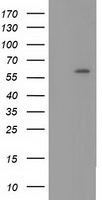 CYP1A2 Antibody in Western Blot (WB)