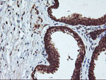 CYP2A6 Antibody in Immunohistochemistry (Paraffin) (IHC (P))