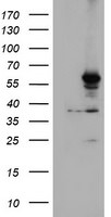 CYP2A6 Antibody in Western Blot (WB)