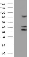 CYP2B6 Antibody in Western Blot (WB)