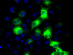 CYP2E1 Antibody in Immunocytochemistry (ICC/IF)