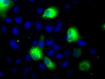 CYP2E1 Antibody in Immunocytochemistry (ICC/IF)