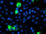 CYP2J2 Antibody in Immunocytochemistry (ICC/IF)