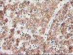 CYP2J2 Antibody in Immunohistochemistry (Paraffin) (IHC (P))