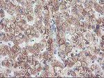 CYP2J2 Antibody in Immunohistochemistry (Paraffin) (IHC (P))