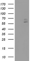 CYP2J2 Antibody in Western Blot (WB)