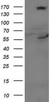 CYP2J2 Antibody in Western Blot (WB)