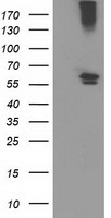 CYP2J2 Antibody in Western Blot (WB)