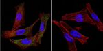 P-cadherin Antibody in Immunocytochemistry (ICC/IF)