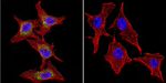 P-cadherin Antibody in Immunocytochemistry (ICC/IF)