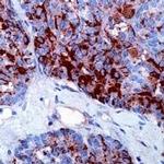 Calcitonin Antibody in Immunohistochemistry (Paraffin) (IHC (P))