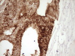 Calcitonin (CALCA) Antibody in Immunohistochemistry (Paraffin) (IHC (P))