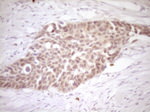 Calcitonin (CALCA) Antibody in Immunohistochemistry (Paraffin) (IHC (P))