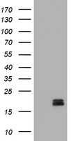 Calcitonin (CALCA) Antibody in Western Blot (WB)