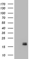 Calcitonin (CALCA) Antibody in Western Blot (WB)