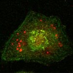 Calnexin Antibody in Immunocytochemistry (ICC/IF)