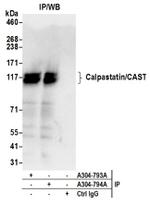 Calpastatin/CAST Antibody in Western Blot (WB)