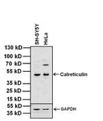 Calreticulin Antibody in Western Blot (WB)