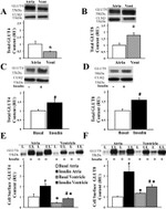 Calreticulin Antibody in Western Blot (WB)