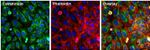 Calreticulin Antibody in Immunocytochemistry (ICC/IF)