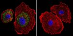 Calsequestrin Antibody in Immunocytochemistry (ICC/IF)