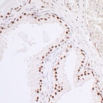 Caper Antibody in Immunohistochemistry (IHC)