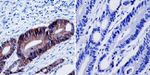 beta Catenin Antibody in Immunohistochemistry (Paraffin) (IHC (P))