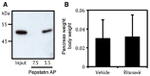 Cathepsin E Antibody in Western Blot (WB)