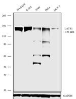 LATS1 Antibody in Western Blot (WB)