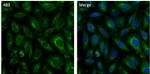 Clathrin Heavy Chain Antibody in Immunocytochemistry (ICC/IF)