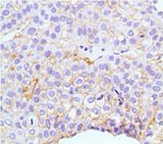 Claudin 1 Antibody in Immunohistochemistry (Paraffin) (IHC (P))