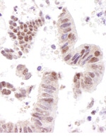 CoAA Antibody in Immunohistochemistry (IHC)