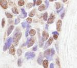 CoAA Antibody in Immunohistochemistry (IHC)