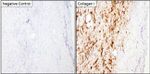 Collagen I Antibody in Immunohistochemistry (Paraffin) (IHC (P))