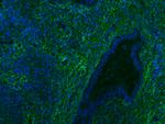 Collagen I Antibody in Immunohistochemistry (IHC)