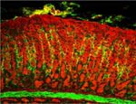 Collagen I Antibody in Immunohistochemistry (IHC)