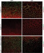 Connexin 26 Antibody in Immunohistochemistry (IHC)