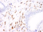 Coronin 1 Antibody in Immunohistochemistry (IHC)