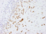 Coronin 1 Antibody in Immunohistochemistry (IHC)