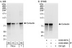 Cortactin Antibody in Western Blot (WB)