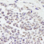 Cul3 Antibody in Immunohistochemistry (IHC)