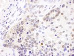 Cul4B Antibody in Immunohistochemistry (IHC)