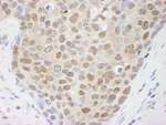 Cul4a Antibody in Immunohistochemistry (IHC)