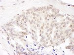 Cul5 Antibody in Immunohistochemistry (IHC)