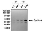 Cyclin A2 Antibody in Immunoprecipitation (IP)