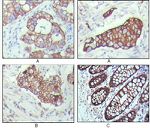 Cytokeratin 19 Antibody in Immunohistochemistry (Paraffin) (IHC (P))